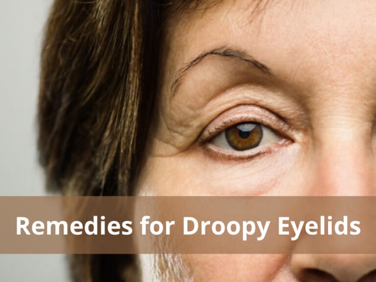 Droopy Eyelid (Ptosis): Remedies for Droopy Eyelids